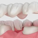 서산치과기공소 이미지