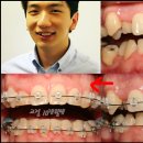 정체교정