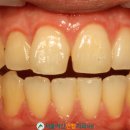 진천치과기공소 이미지