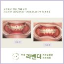 여의도세브란스치과의원 | 여의도 교정 연세라벤더치과 "6월 성인 치아교정 후기"