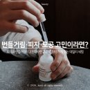 오디너리뷰티 | 피지·모공 고민이라면? 디 오디너리 나이아신아마이드 10% + 징크 1% 후기