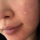 울트라케어 | 얼굴 오돌토돌 피부 진정템 찾았다! 모낭염 좁쌀여드름 피부의 지루샵 세라케어 울트라앰플 후기