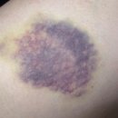 포이즌흉부외과의원 이미지