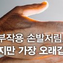 ​ 항암치료 부작용 손발저림 말초신경증병, 초기 대응이 중요합니다 이미지