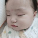 백선세탁 | 신생아 안약투약 주의사항. 다래끼 결막염 진료 후기.