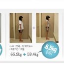 한지영한의원 | 얼굴부터 다리까지, 붓기 제거 루틴 제나한의원비용 대전 제나한의원