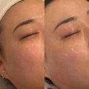 에피소드 | [인천/서구]검단에스테틱 30대 속건조 탈출기! 우리왁싱&amp;뷰티 딥 수분 케어 정착 후기