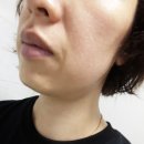 셀그래프트