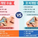 일퍼센트성형외과의원 이미지