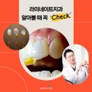 강남무삭제라미네이트 상담 후기, “앞니 삭제 많이 해야 하나 걱정됐어요”