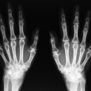 경희바른의원 이미지