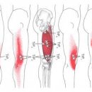 무릎때문에 허리가 아플수도 있다_TFL, Vastus Lateralis 이미지