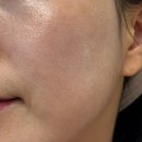 보떼샤인 | 대구 에스테틱 화장품 보떼덤 체험 가능한 샤인뷰티샵