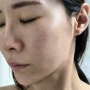 내일 | 연신내피부관리 유지기간 오래가는 내일의피부 후기