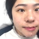 원흥 | [고양] 원흥속눈썹 아이율 | 프리미엄율펌 후기｜무쌍 비포애프터 레전드