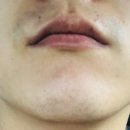 송준호레이메디의원 이미지