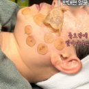 봄스피부과의원 티스토리
