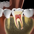 수지플란트치과의원 이미지