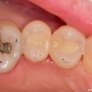 새로치과기공소 이미지