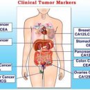 암 치료 과정에서 종양표지자 검사 수치란 무엇인가? 이미지