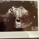 효성민박 | [임신6,7주차] 임신확인서 발급/국민행복카드/난황발견/아기발견/질정처방/임신증상/지온산후조리원 예약