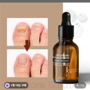 엔케이(NK)솔루션 이미지