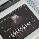 춘천태동요양병원 | 37주 임산부 태동검사 시기 및 지옥의 내진 일기 (춘천 미래산부인과)