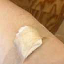 베데스다약국 | 갑상선암 수술 후 첫 외래(조직검사결과, 보험청구서류발급)