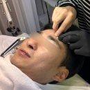 Skin 25 | 성인여드름압출 ‘피부보기(skin biew)’후기, 마포피부관리 (Feat. 이래서 관리받는구나...)