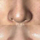 예하 | W-5 | 인천 피부관리 주안 예하에스테틱 관리 후기