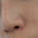 도로시 | 서면스킨부스터 물광주사 도로시 악건성 피부 찐 후기