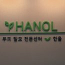 한올두피탈모