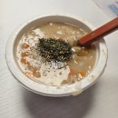맘스동물약국 | [난임일기 11] 시험관 1차 난자채취 D-Day, 난자채취 후기