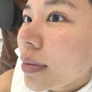 샵레오네 | 평택 고덕 신도시뷰티샵 ' 레오네뷰티 ' 스킨플래닝 후기