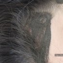 설이헤어라인 이미지