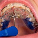 가지런이치과교정과의원 이미지