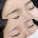 의정부경전철 송산역 이미지