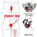 더의선한의원 | 빙판길 엉덩방아 치료후기 - 서초동 더의선한의원