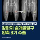 24시 더휴동물의료센터 | 양산 강아지 슬개골 탈구 수술 후기 수술 전문 동물병원 [24시 더휴동물의료센터]