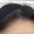 아토컷트