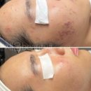 채움뷰티 네이버블로그