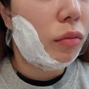 윤곽주사효과 얼굴살빼는법 정리 후기