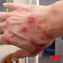 동해시보건소 이미지