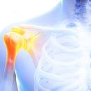 DMC수색신경외과의원 이미지