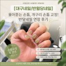 메트로센터상가(B2) | [대구네일/반월당네일] 물어뜯는 손톱, 개구리 손톱 교정! 반달네일 연장 후기