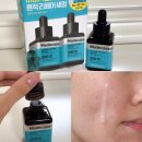 메디힐케어 | 여드름흔적 색소침착 피부장벽 케어 메디힐 마데카소사이드 흔적세럼 내돈내산 솔직후기