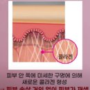 역발산센터 | 마곡역발산역피부과 여드름 흉터 쥬베룩볼륨 놀라운...by 쥬베룩키닥터 포텐자 펌핑팁 리서치센터