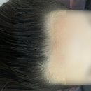 이화부분정비 | 서울 홍대헤어라인문신 n년 고민하다 드디어 해본 솔직 후기, 전후사진, 통증, 관리법까지