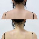겸서뷰티 대구 눈썹&왁싱 | 하남 미사 신부 예신관리 맛집 '뷰티온유왁싱&눈썹&스킨케어 미사역본점' 승모근 없애고 대만족 후기!