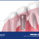 든든한치과의원 이미지